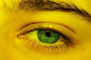 Zespół Gilberta -2 mutacje UGT1A1*28 UGT1A1*6