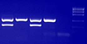 XY-test PCR- identyfikacja płci