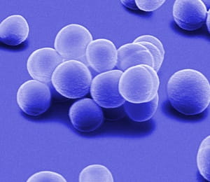 Gronkowce STAAR - Test PCR (Staphylococcus, gronkowiec MRSA, VRSA)