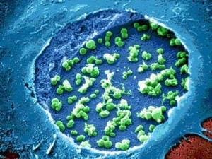 Chlamydia Multiplex PCR1: Chlamydia trachomatis, Ureaplasma urealyticum, Neisseria gonorrhoeae