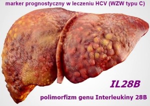 IL28B (Polimorfizm Interleukiny 28B) marker prognostyczny w leczniu HCV