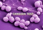 CANDIDA TEST PCR (Kandydoza ogólnoustrojowa z krwi)