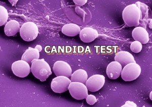 CANDIDA TEST PCR (Kandydoza ogólnoustrojowa z krwi)