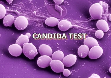 candida PCR.jpg