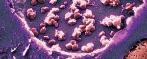 Mycoplasma sp. PCR