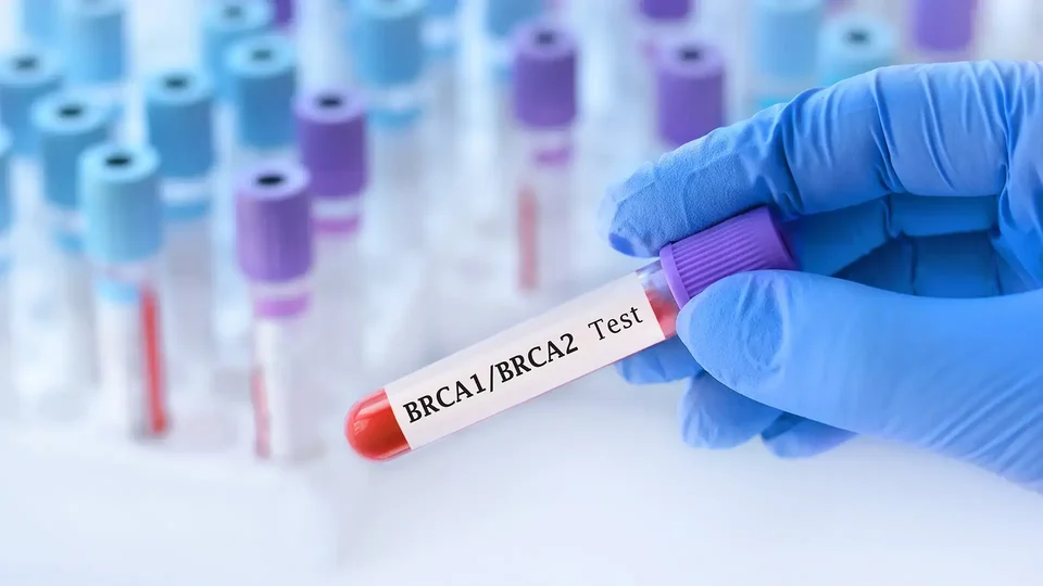 Badanie BRCA1/BRCA2 – kto powinien je wykonać i co oznaczają wyniki dla całej rodziny?